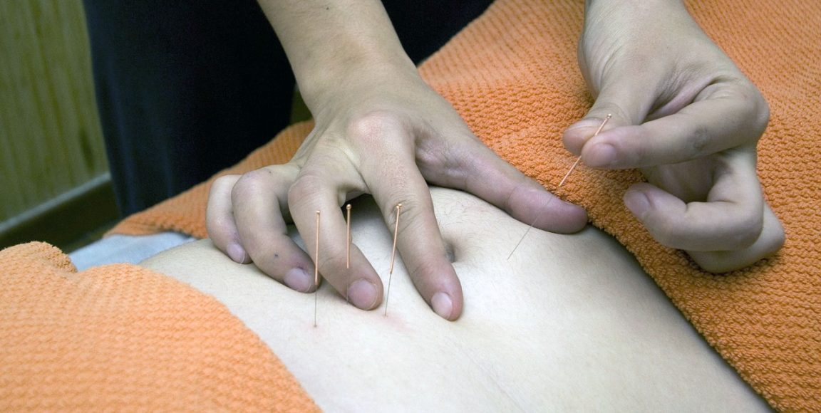 Cum acupunctura poate trata constipația și îmbunătăți sănătatea digestivă