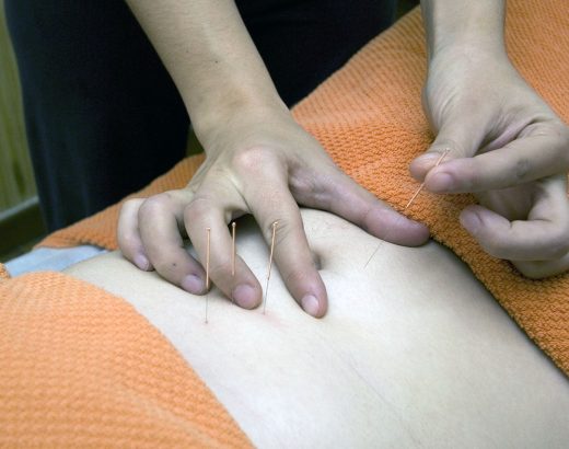 Cum acupunctura poate trata constipația și îmbunătăți sănătatea digestivă